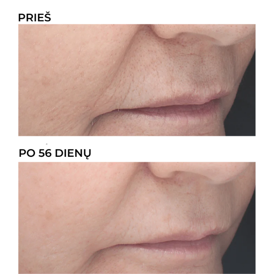 Retinoidų naktinis 6% koncentratas nuo raukšlių RETINAL, 30ml
