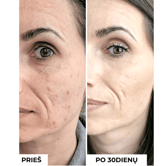 Koncentratas mažinti randelius ir pigmentaciją TXA 3% ANTI-DARK SPOTS CONCENTRATE
