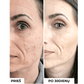 Koncentratas mažinti randelius ir pigmentaciją TXA 3% ANTI-DARK SPOTS CONCENTRATE