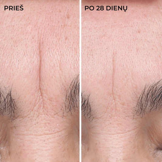 Intensyviai drėkinantis serumas koncentratas HYAL FILLER, 30ml