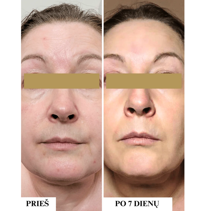 Apsauginis drėkinamasis kremas nuo saulės sausai, jautriai odai SPF 50, 50ml