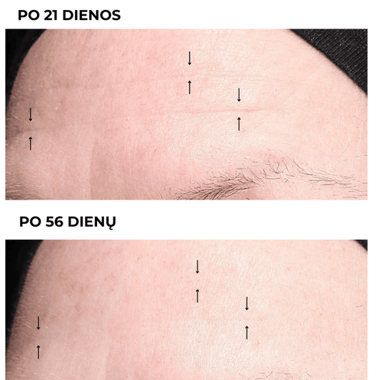 Intensyvus naktinis veido kremas INTENSE NIGHT CREAM