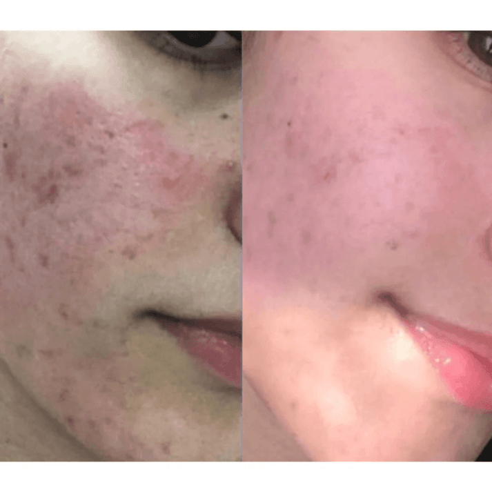 Atkuriamasis kremas pažeistai odai CICADERM, 30ml