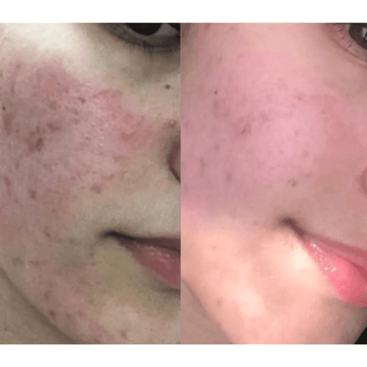 Atkuriamasis kremas pažeistai odai CICADERM, 30ml